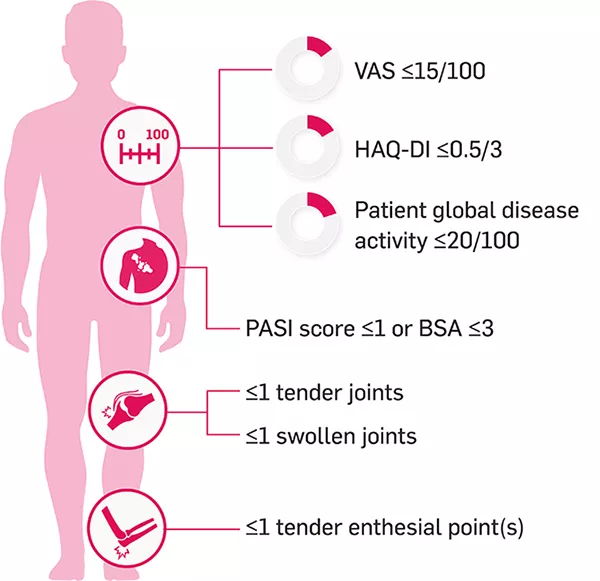 Explanatory graphic for MDA score